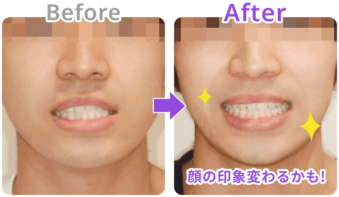 before after
